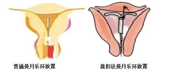 圖文圖片