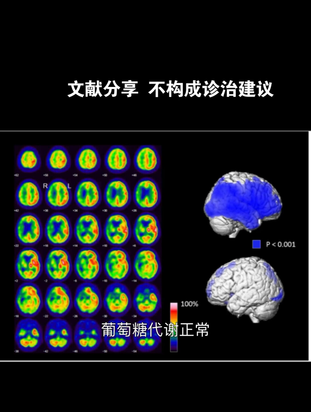 默认图片