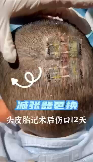 視頻封面
