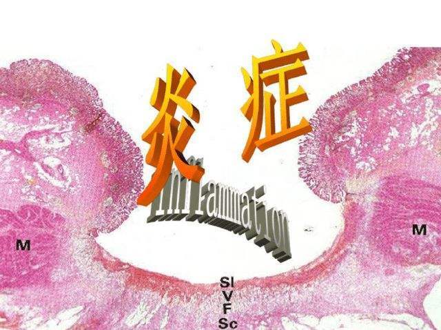 圖文圖片