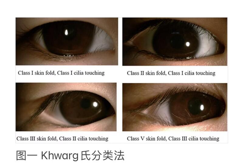 圖文圖片