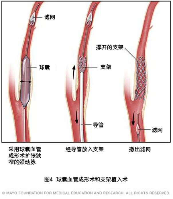 圖文圖片