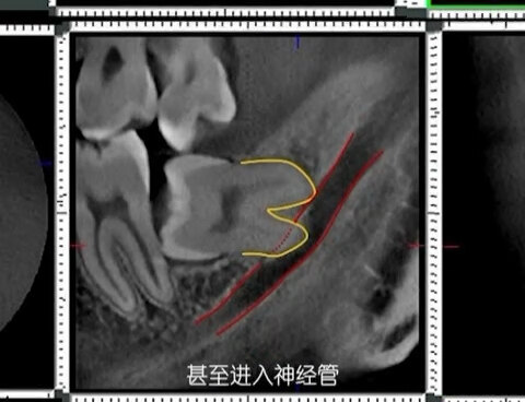 默认图片