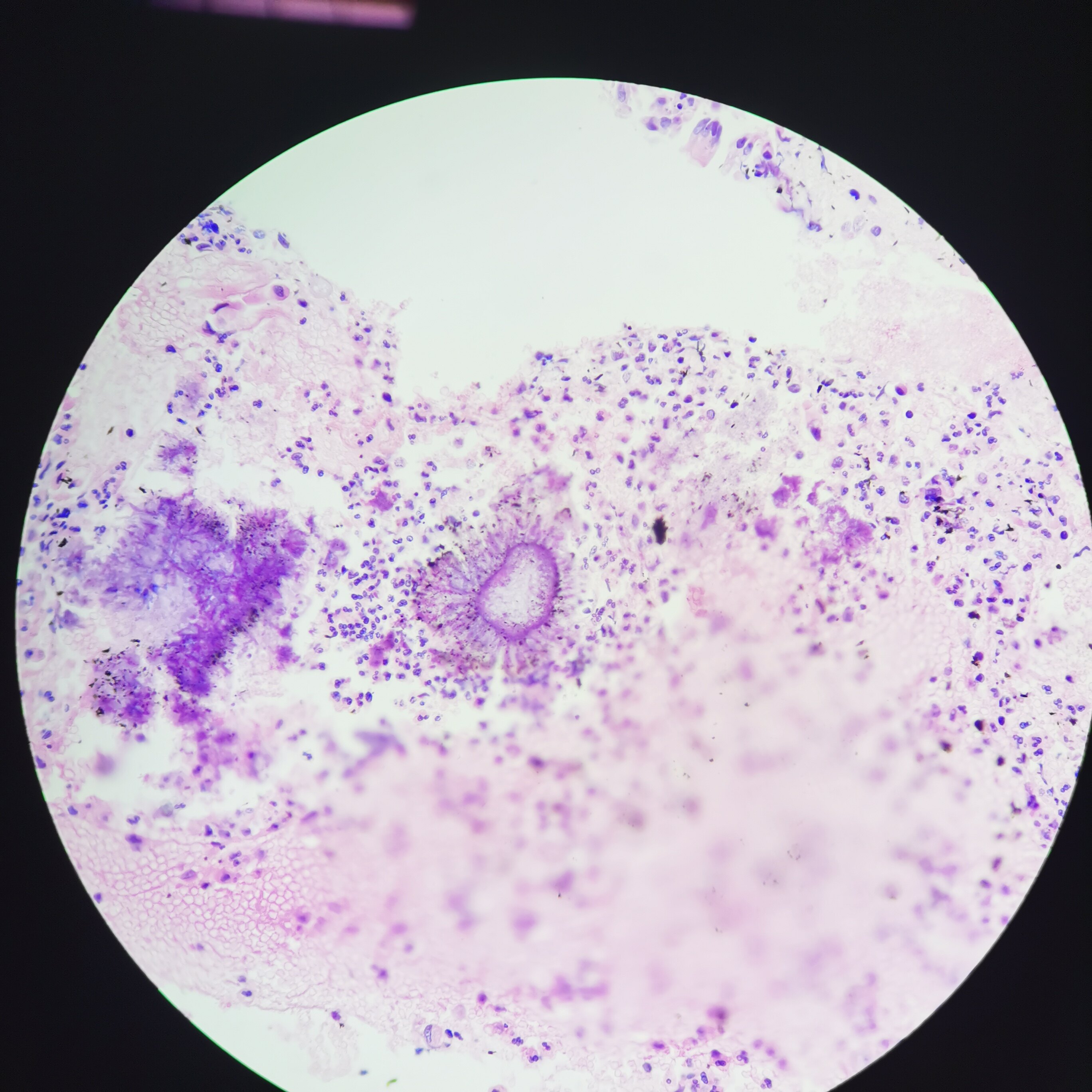 放线菌显微镜下的图片图片