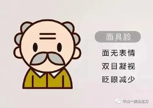 脸部的表情也会减少,眨眼少,眼睛下垂,目光呆滞,似乎失去了七情六欲