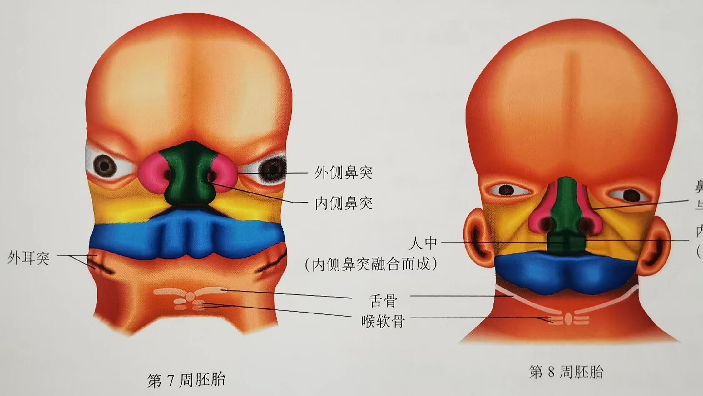 鼻骨缺失图片