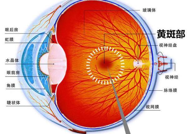 高度近視患者最怕的併發症之黃斑疾病_黃斑病_介紹_發病原因_症狀表現