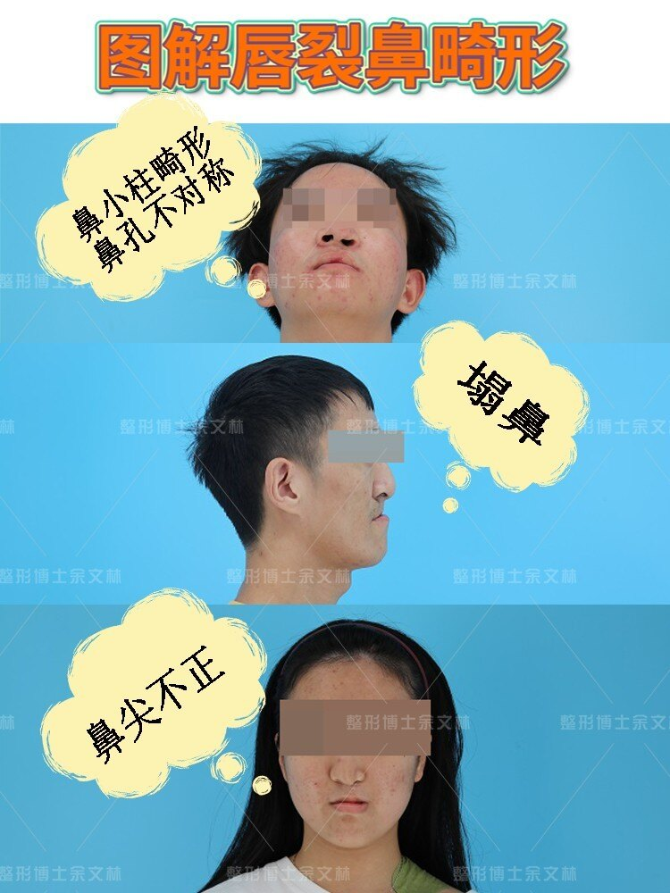 圖文圖片
