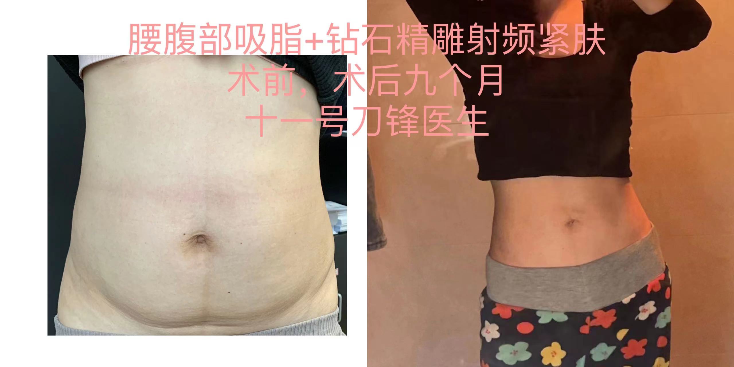 圖文圖片