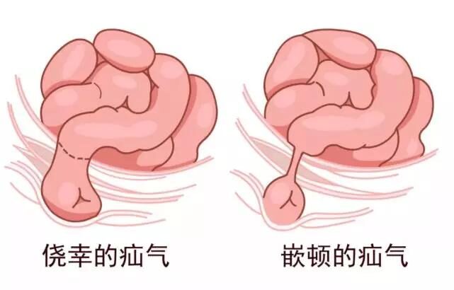 肚皮鼓包怎么回事疝气就医指南看完这篇总结就够了