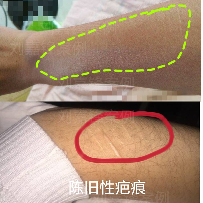 圖文圖片