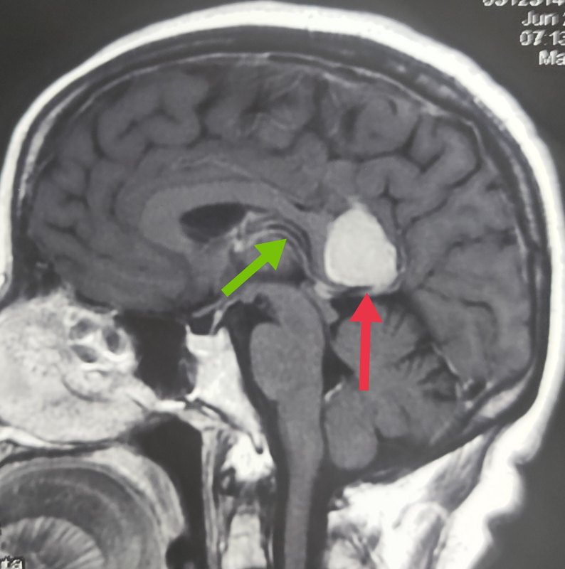 天坛医院核磁加急-天坛医院做核磁要等多久 天坛医院核磁加急-天坛医院做核磁要等多久