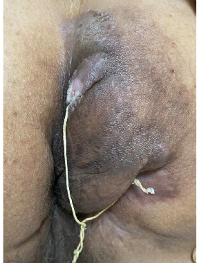 圖文圖片