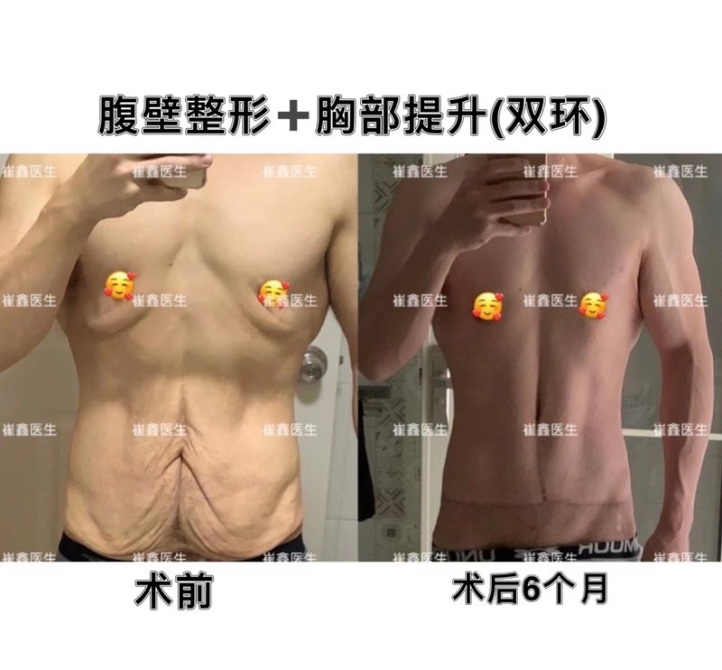 圖文圖片