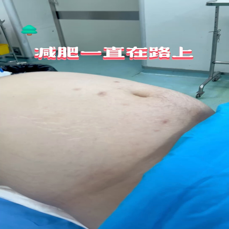 視頻封面