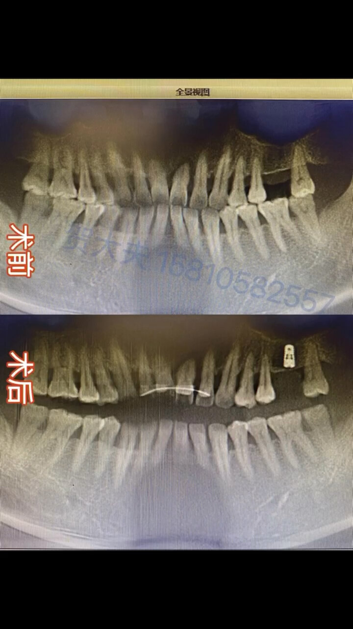 默认图片