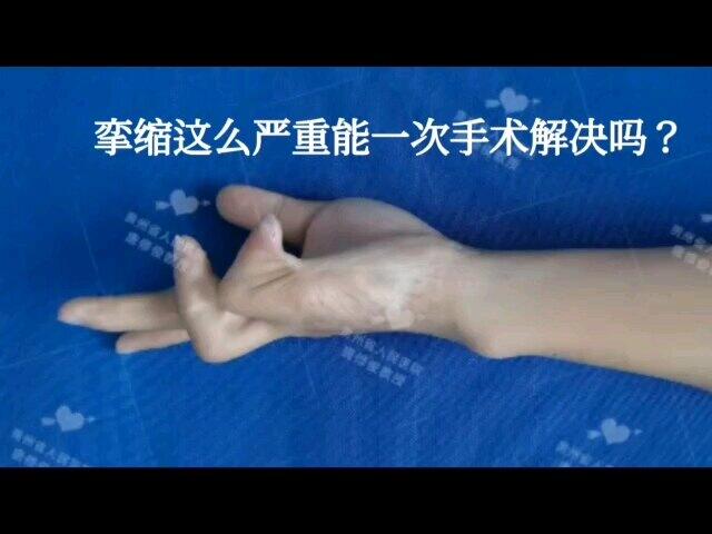 視頻封面