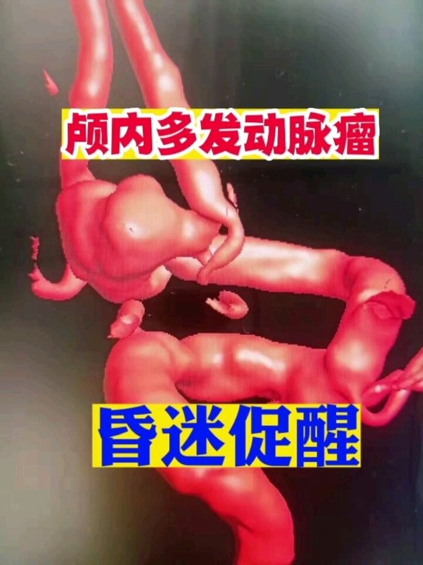 視頻封面