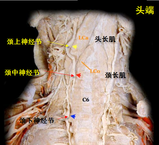 星状神经节解剖定位图片
