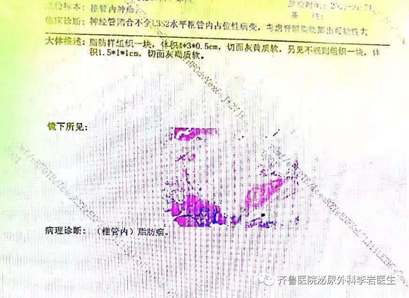 圖文圖片