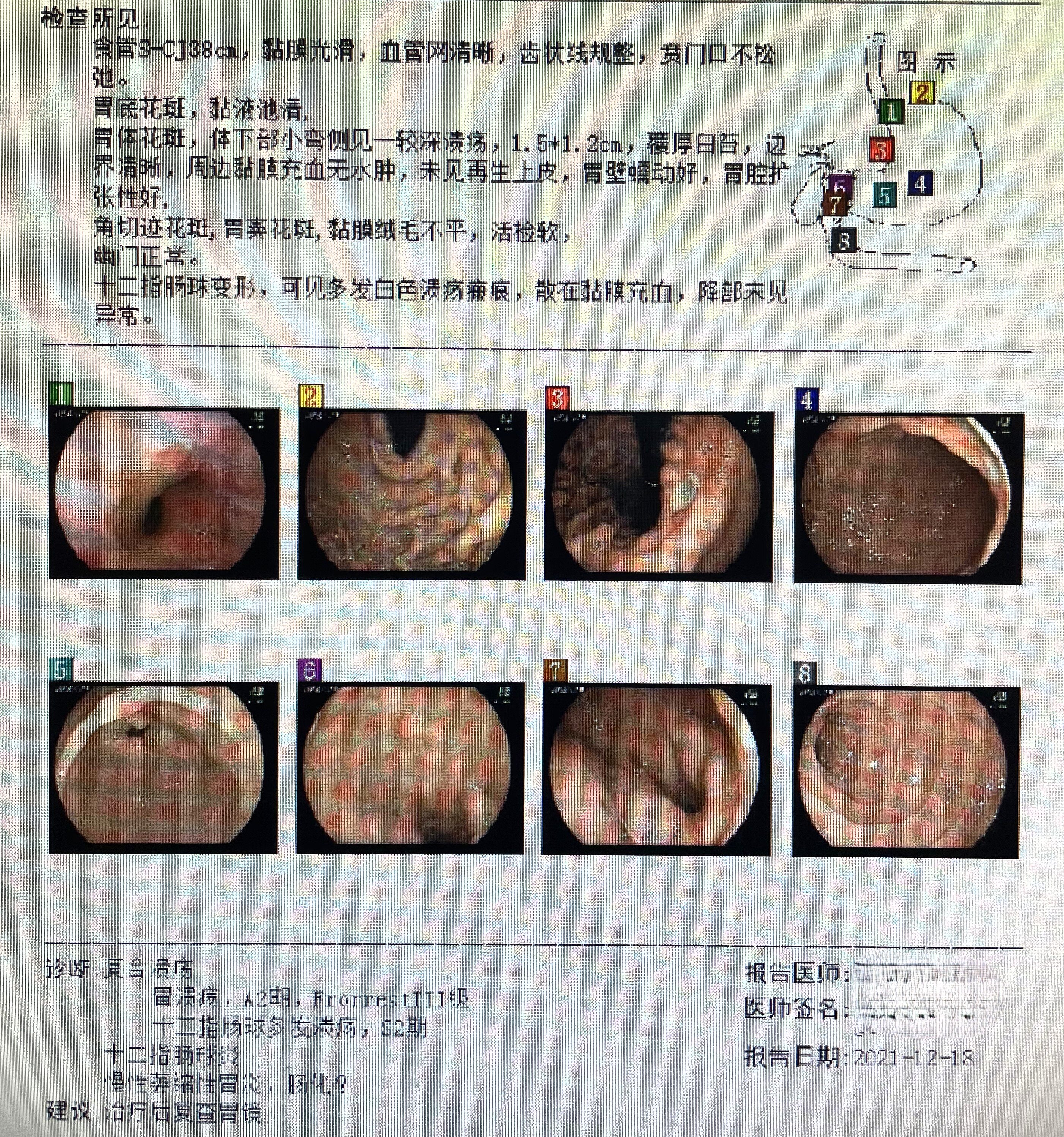 堵德水胃镜1.jpg