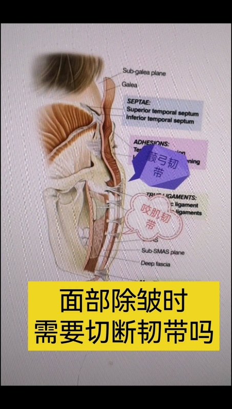 視頻封面