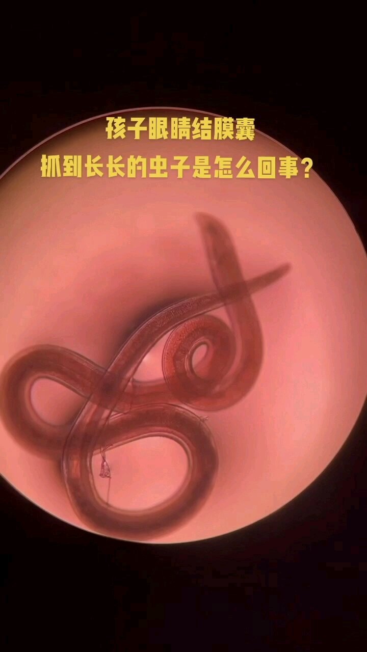 視頻封面