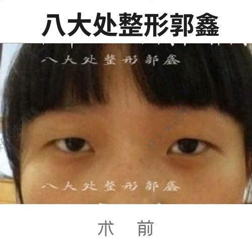 圖文圖片