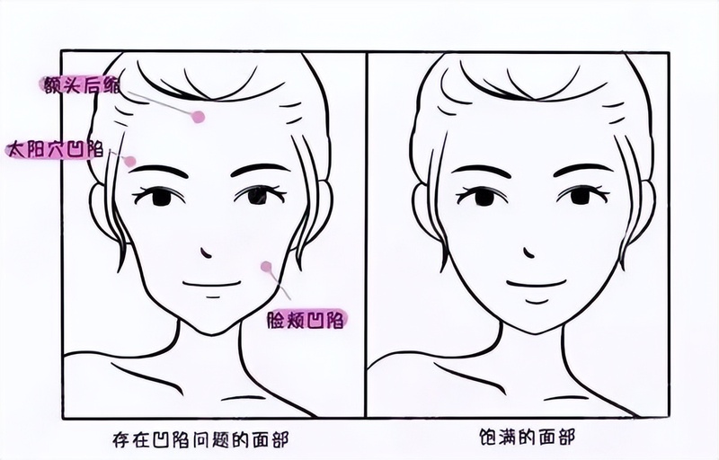 圖文圖片