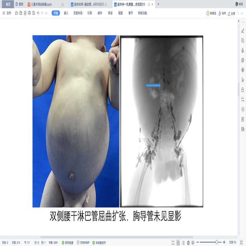 圖文圖片