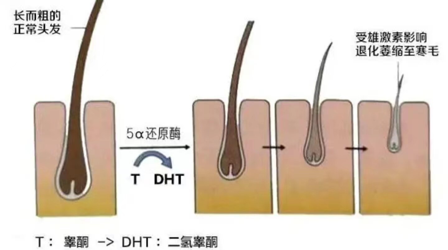 毛囊在什麼情況下會壞死?_植髮_介紹_治療介紹 - 好大夫在線