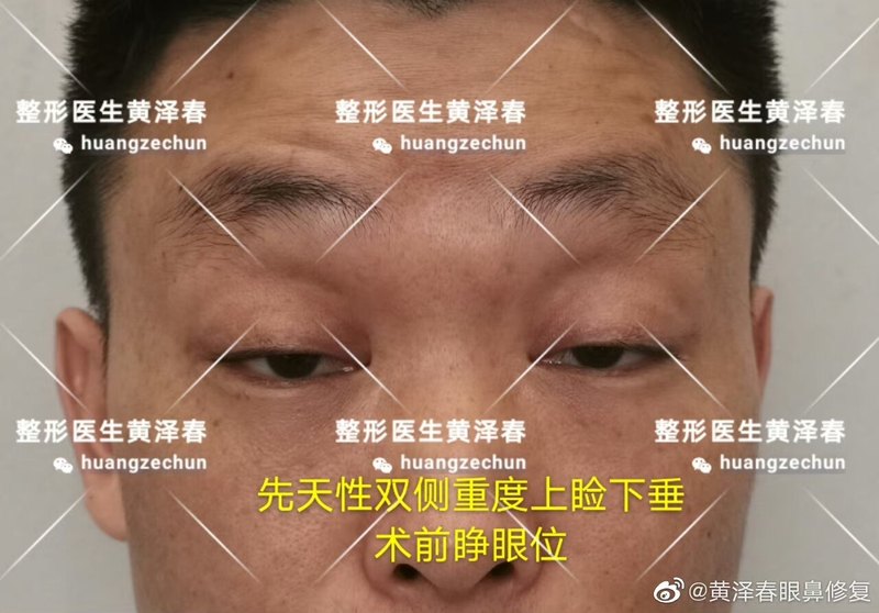 圖文圖片