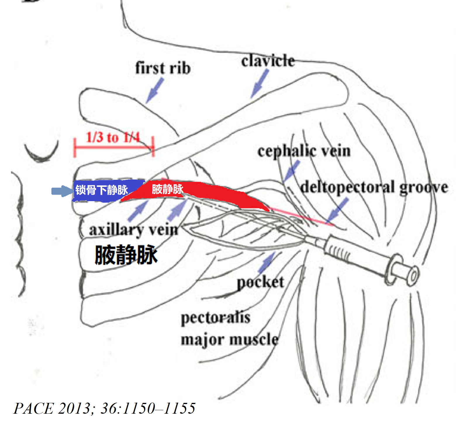 腋静脉解剖图图片
