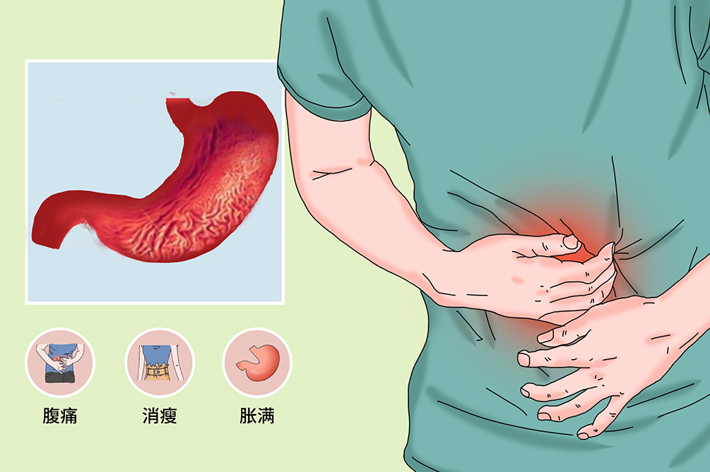 安军明主任医师针灸治疗老年慢性萎缩性胃炎一则 - 好大夫在线