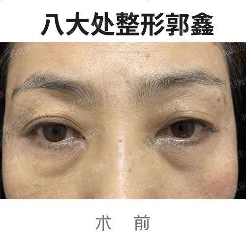 圖文圖片