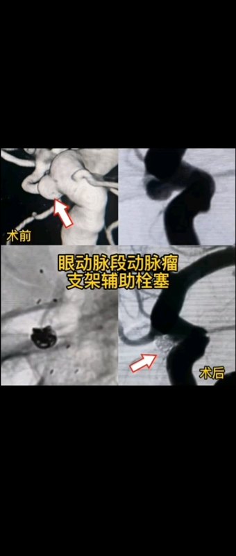 視頻封面