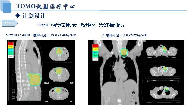 替吉奥,奥沙利铂,洛铂,tas-102) 免疫治疗(2021年11月,恩沃利单抗注射