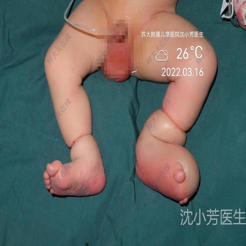 圖文圖片