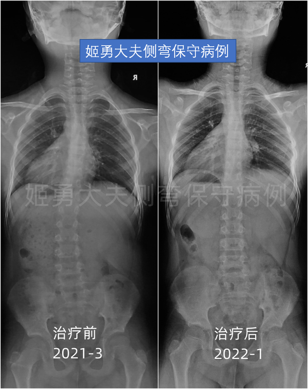 圖文圖片