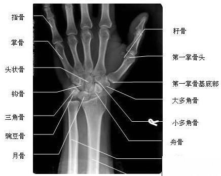 標準的腕關節正位像平時醫生說拍個片子,其實就是做個x光片,也就是