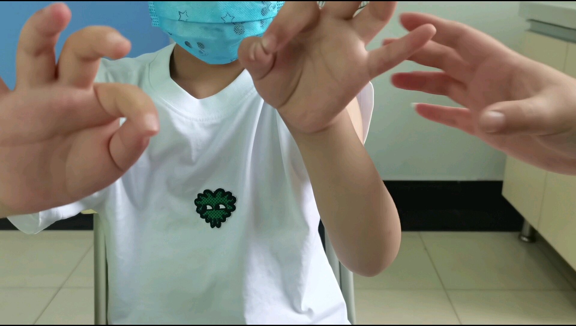 右肱骨髁上骨折术后6周 正中神经完全损伤 骨折 右肱骨髁上骨折术后6周 正中神经完全损伤 骨折