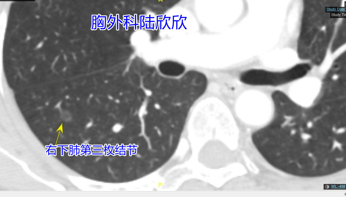 右下3薄层90副本.jpg