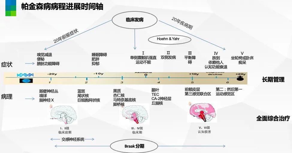 手术无法根治帕金森病,为什么还要选择?