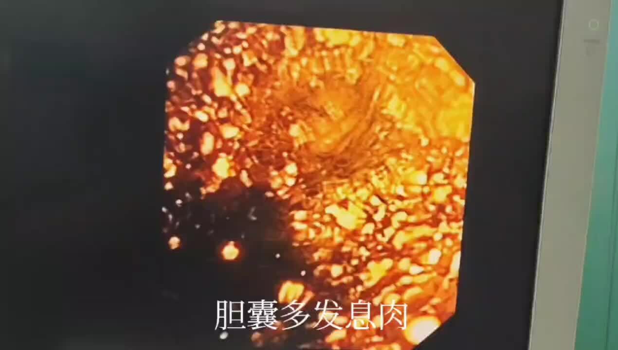 視頻封面