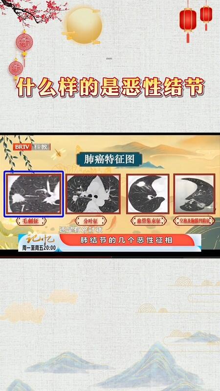 視頻封面