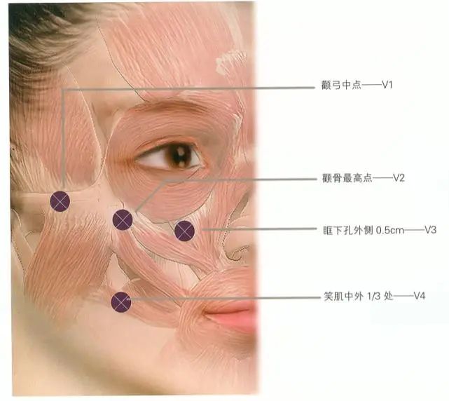 我们的面部也是有韧带的哦,它可以固定和支持面颊部皮肤 .