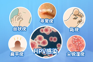 hpv感染了怎么办？
