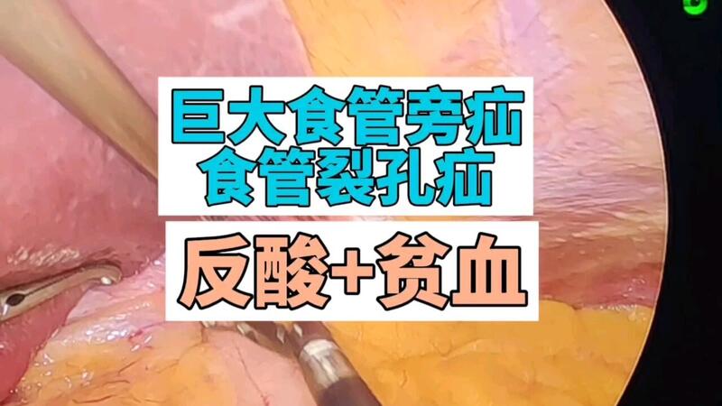 視頻封面
