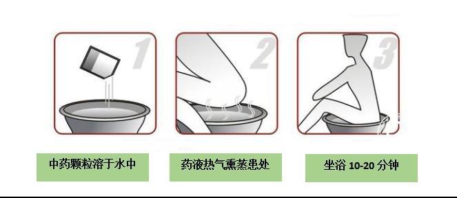 排便前温水坐浴,使肛门括约肌松弛,能减轻粪便对肛裂的冲击;便后坐浴
