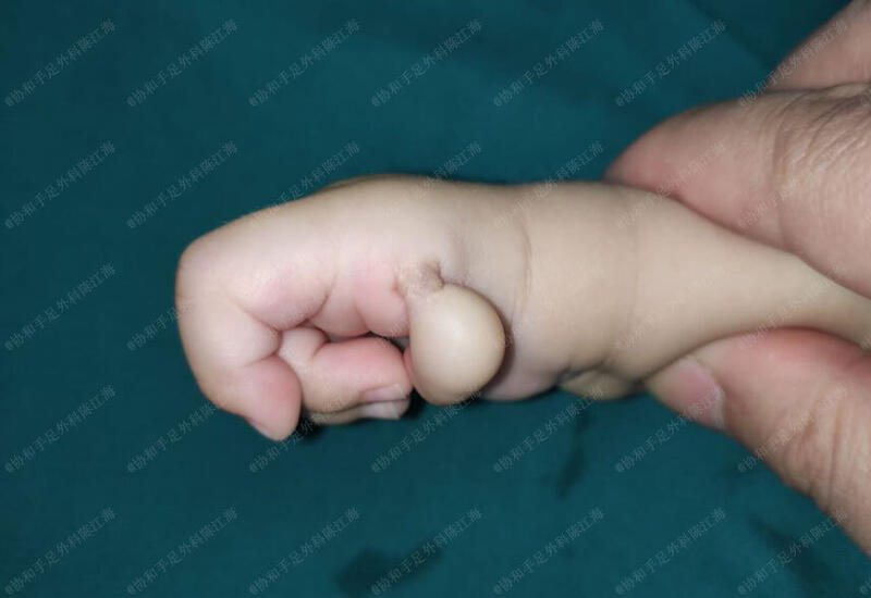 圖文圖片